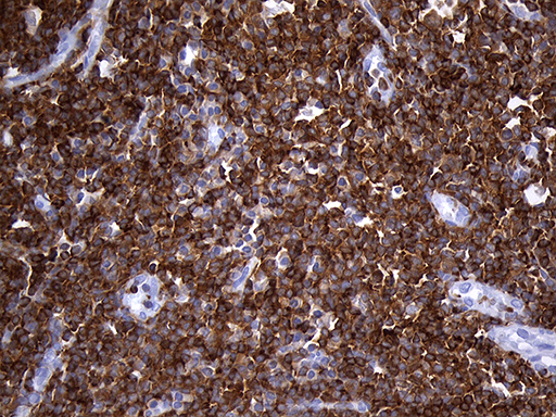 SH3BP1 Antibody - Immunohistochemical staining of paraffin-embedded Human tonsil within the normal limits using anti-SH3BP1 mouse monoclonal antibody. (Heat-induced epitope retrieval by 1mM EDTA in 10mM Tris buffer. (pH8.5) at 120°C for 3 min. (1:500)