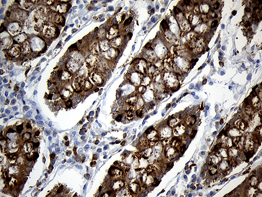 SH3BP1 Antibody - Immunohistochemical staining of paraffin-embedded Human colon tissue within the normal limits using anti-SH3BP1 mouse monoclonal antibody. (Heat-induced epitope retrieval by 1mM EDTA in 10mM Tris buffer. (pH8.5) at 120°C for 3 min. (1:500)
