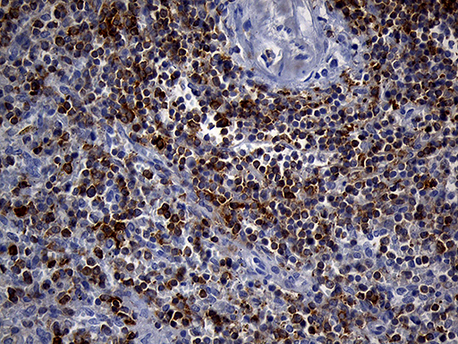SH3BP1 Antibody - Immunohistochemical staining of paraffin-embedded Human spleen tissue within the normal limits using anti-SH3BP1 mouse monoclonal antibody. (Heat-induced epitope retrieval by 1mM EDTA in 10mM Tris buffer. (pH8.5) at 120°C for 3 min. (1:500)