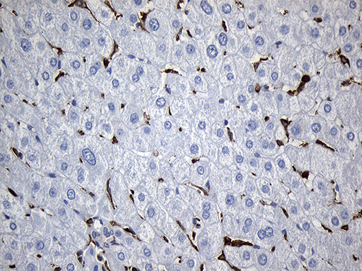 SH3BP1 Antibody - Immunohistochemical staining of paraffin-embedded Human liver tissue within the normal limits using anti-SH3BP1 mouse monoclonal antibody. (Heat-induced epitope retrieval by 1mM EDTA in 10mM Tris buffer. (pH8.5) at 120°C for 3 min. (1:500)