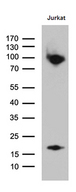 SH3BP1 Antibody - Western blot analysis of extracts. (35ug) from Jurkat cell line by using anti-SH3BP1 monoclonal antibody. (1:500)