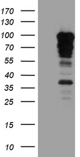 SH3BP1 Antibody - HEK293T cells were transfected with the pCMV6-ENTRY control. (Left lane) or pCMV6-ENTRY SH3BP1. (Right lane) cDNA for 48 hrs and lysed