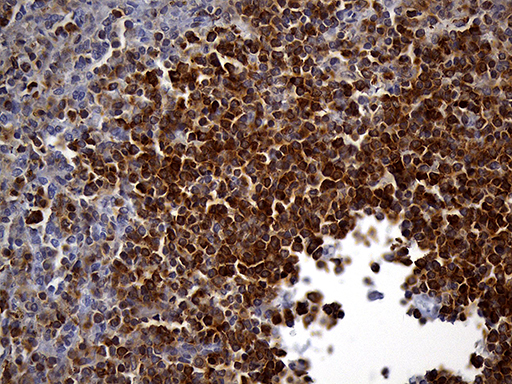 SH3BP1 Antibody - Immunohistochemical staining of paraffin-embedded Human spleen tissue within the normal limits using anti-SH3BP1 mouse monoclonal antibody. (Heat-induced epitope retrieval by 1mM EDTA in 10mM Tris buffer. (pH8.5) at 120°C for 3 min. (1:2000)