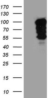 SH3BP1 Antibody - HEK293T cells were transfected with the pCMV6-ENTRY control. (Left lane) or pCMV6-ENTRY SH3BP1. (Right lane) cDNA for 48 hrs and lysed. Equivalent amounts of cell lysates. (5 ug per lane) were separated by SDS-PAGE and immunoblotted with anti-SH3BP1. (1:2000)