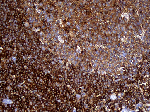 SH3BP1 Antibody - Immunohistochemical staining of paraffin-embedded Human tonsil within the normal limits using anti-SH3BP1 mouse monoclonal antibody. (Heat-induced epitope retrieval by 1mM EDTA in 10mM Tris buffer. (pH8.5) at 120°C for 3 min. (1:500)