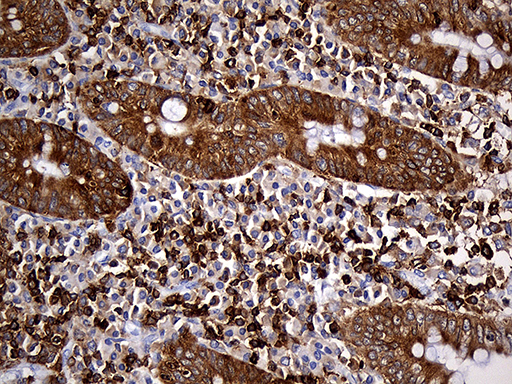 SH3BP1 Antibody - Immunohistochemical staining of paraffin-embedded Human appendix tissue within the normal limits using anti-SH3BP1 mouse monoclonal antibody. (Heat-induced epitope retrieval by 1mM EDTA in 10mM Tris buffer. (pH8.5) at 120°C for 3 min. (1:500)