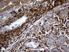 SH3BP1 Antibody - Immunohistochemical staining of paraffin-embedded Human pancreas tissue within the normal limits using anti-SH3BP1 mouse monoclonal antibody. (Heat-induced epitope retrieval by 1mM EDTA in 10mM Tris buffer. (pH8.5) at 120°C for 3 min. (1:2000)