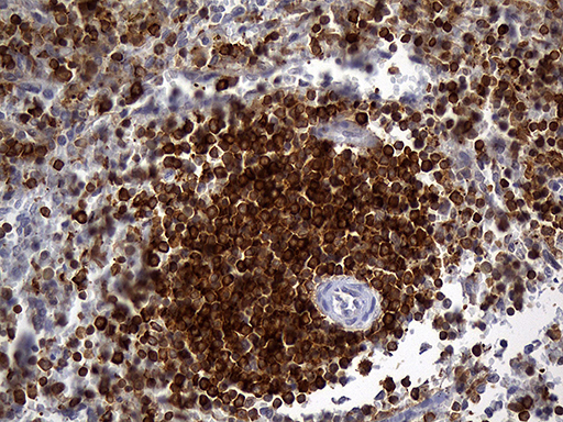 SH3BP1 Antibody - Immunohistochemical staining of paraffin-embedded Human spleen tissue within the normal limits using anti-SH3BP1 mouse monoclonal antibody. (Heat-induced epitope retrieval by 1mM EDTA in 10mM Tris buffer. (pH8.5) at 120°C for 3 min. (1:2000)