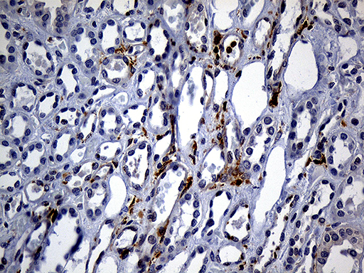 SH3BP1 Antibody - Immunohistochemical staining of paraffin-embedded Human Kidney tissue within the normal limits using anti-SH3BP1 mouse monoclonal antibody. (Heat-induced epitope retrieval by 1mM EDTA in 10mM Tris buffer. (pH8.5) at 120°C for 3 min. (1:2000)