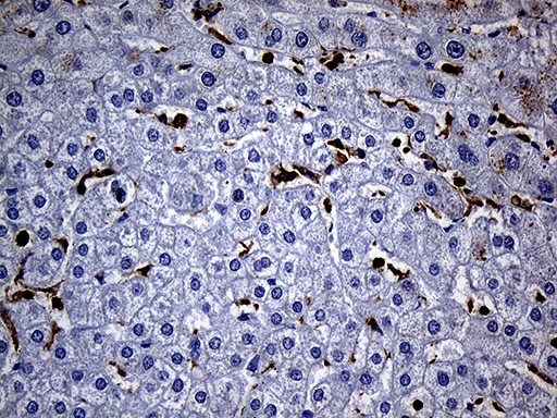 SH3BP1 Antibody - Immunohistochemical staining of paraffin-embedded Human liver tissue within the normal limits using anti-SH3BP1 mouse monoclonal antibody. (Heat-induced epitope retrieval by 1mM EDTA in 10mM Tris buffer. (pH8.5) at 120°C for 3 min. (1:2000)