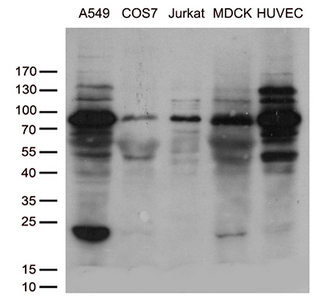 SH3BP1 Antibody - Western blot analysis of extracts. (35ug) from cell lines and/or tissue lysates by using anti-SH3BP1 monoclonal antibody.