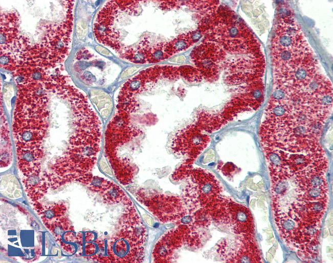 SH3BP2 Antibody - Anti-SH3BP2 antibody IHC of human kidney. Immunohistochemistry of formalin-fixed, paraffin-embedded tissue after heat-induced antigen retrieval. Antibody concentration 5 ug/ml.  This image was taken for the unconjugated form of this product. Other forms have not been tested.