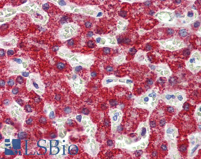 SH3BP2 Antibody - Anti-SH3BP2 antibody IHC of human liver. Immunohistochemistry of formalin-fixed, paraffin-embedded tissue after heat-induced antigen retrieval. Antibody concentration 5 ug/ml.  This image was taken for the unconjugated form of this product. Other forms have not been tested.