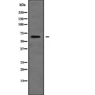 SH3BP2 Antibody - Western blot analysis of SH3BP2 expression in SH3B 721_B cells lysate. The lane on the left is treated with the antigen-specific peptide.