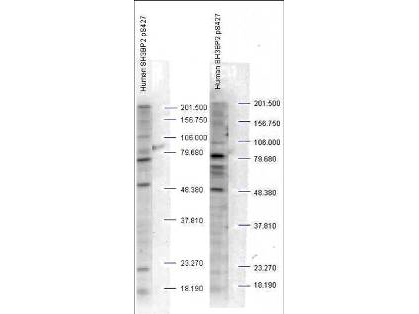 SH3BP2 Antibody - Anti-SH3BP2 pS427 Antibody - Western Blot. Western blot analysis is shown using Affinity Purified anti-SH3BP2 pS427 antibody to detect endogenous protein present in unstimulated human whole cell lysates). The band as indicated by the arrowheads is evident in both M059 cells (panel A) and PC-3 cells (panel B). Comparison to a molecular weight marker indicates a band of ~60 kD corresponding to human SH3BP2 protein. The blot was incubated with a 1:500 dilution of the antibody at room temperature followed by detection using standard techniques. Personal communication Steven Pelech, Kinexus Inc.