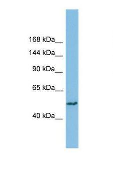 SH3BP4 Antibody - Western blot of Human THP-1. SH3BP4 antibody dilution 1.0 ug/ml.  This image was taken for the unconjugated form of this product. Other forms have not been tested.