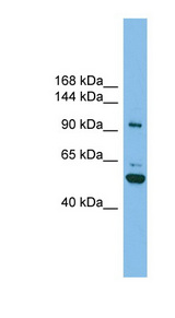 SH3BP4 Antibody - SH3BP4 antibody Western blot of ACHN lysate. This image was taken for the unconjugated form of this product. Other forms have not been tested.