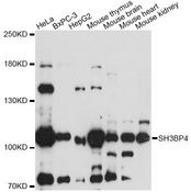SH3BP4 Antibody - Western blot analysis of extracts of various cell lines, using SH3BP4 antibody at 1:1000 dilution. The secondary antibody used was an HRP Goat Anti-Rabbit IgG (H+L) at 1:10000 dilution. Lysates were loaded 25ug per lane and 3% nonfat dry milk in TBST was used for blocking. An ECL Kit was used for detection and the exposure time was 90s.