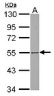SH3BP5 / SAB Antibody - Sample (30 ug of whole cell lysate) A: Jurkat 10% SDS PAGE SH3BP5 antibody diluted at 1:1000