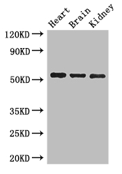 SH3BP5 / SAB Antibody - Positive WB detected in:Mouse heart tissue,Mouse brain tissue,Mouse kidney tissue;All lanes: SH3BP5 antibody at 3ug/ml;Secondary;Goat polyclonal to rabbit IgG at 1/50000 dilution;Predicted band size: 51,33 kDa;Observed band size: 51 kDa;