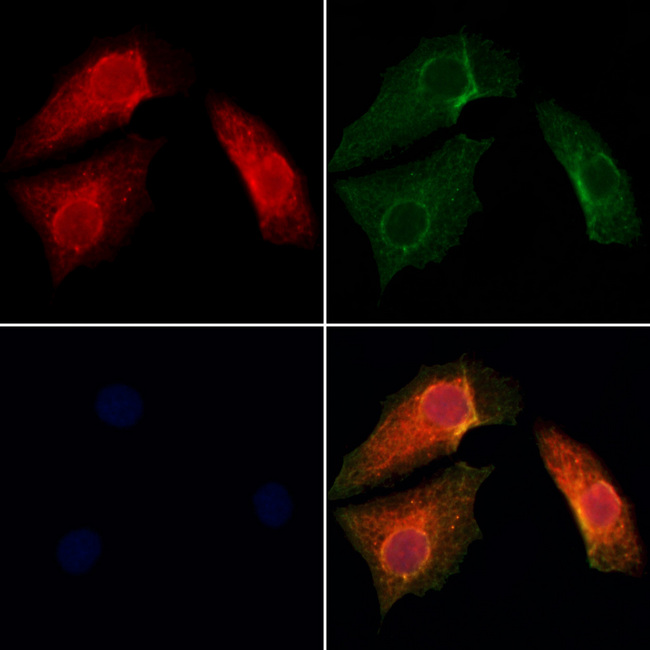 SH3BP5 / SAB Antibody - Staining HeLa cells by IF/ICC. The samples were fixed with PFA and permeabilized in 0.1% Triton X-100, then blocked in 10% serum for 45 min at 25°C. Samples were then incubated with primary Ab(1:200) and mouse anti-beta tubulin Ab(1:200) for 1 hour at 37°C. An AlexaFluor594 conjugated goat anti-rabbit IgG(H+L) Ab(1:200 Red) and an AlexaFluor488 conjugated goat anti-mouse IgG(H+L) Ab(1:600 Green) were used as the secondary antibod