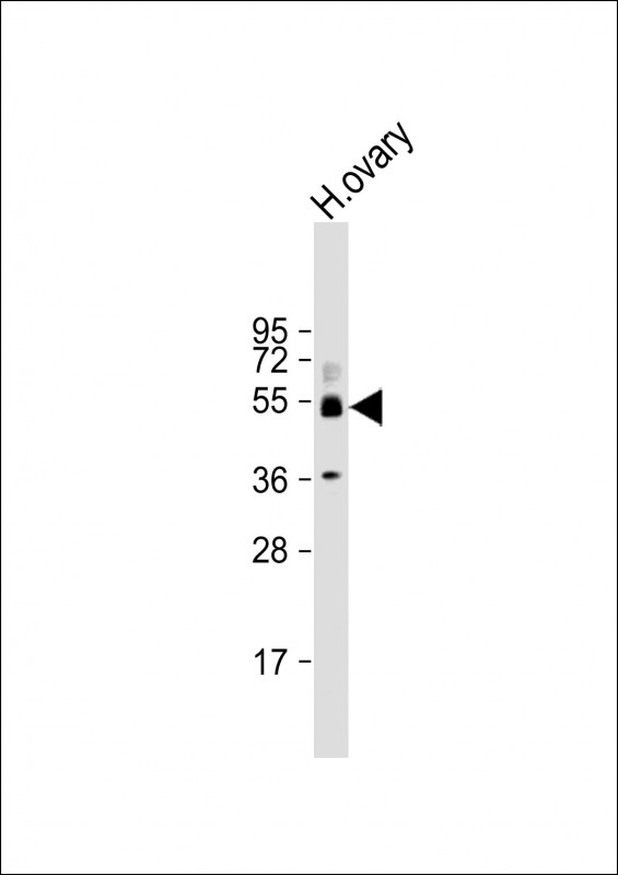 SH3BP5 / SAB Antibody - Anti-SH3BP5 Antibody (N-Term) at 1:2000 dilution + human ovary lysate Lysates/proteins at 20 µg per lane. Secondary Goat Anti-Rabbit IgG, (H+L), Peroxidase conjugated at 1/10000 dilution. Predicted band size: 50 kDa Blocking/Dilution buffer: 5% NFDM/TBST.