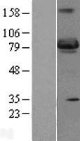 SH3BP5 / SAB Protein - Western validation with an anti-DDK antibody * L: Control HEK293 lysate R: Over-expression lysate