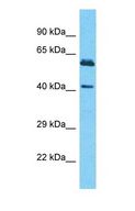 SH3BP5L Antibody - Western blot of SH3BP5L Antibody with human HT1080 Whole Cell lysate.  This image was taken for the unconjugated form of this product. Other forms have not been tested.