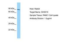 SH3D19 Antibody -  This image was taken for the unconjugated form of this product. Other forms have not been tested.
