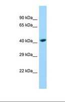 SH3D19 Antibody - Western blot of Jurkat. SHROOM1 antibody dilution 1.0 ug/ml.  This image was taken for the unconjugated form of this product. Other forms have not been tested.