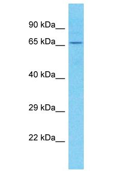 SH3D21 / C1orf113 Antibody - SH3D21 / C1orf113 antibody Western Blot of Placenta. Antibody dilution: 1 ug/ml.  This image was taken for the unconjugated form of this product. Other forms have not been tested.