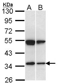 SH3GL1 / EEN Antibody - Sample (30 ug of whole cell lysate). A: Hep G2 , B: Raji. 10% SDS PAGE. SH3GL1 antibody diluted at 1:1000.