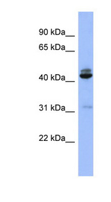 SH3GL1 / EEN Antibody - SH3GL1 / Endophilin-A2 antibody Western blot of Jurkat lysate. This image was taken for the unconjugated form of this product. Other forms have not been tested.
