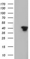 SH3GL1 / EEN Antibody - HEK293T cells were transfected with the pCMV6-ENTRY control (Left lane) or pCMV6-ENTRY SH3GL1 (Right lane) cDNA for 48 hrs and lysed. Equivalent amounts of cell lysates (5 ug per lane) were separated by SDS-PAGE and immunoblotted with anti-SH3GL1.