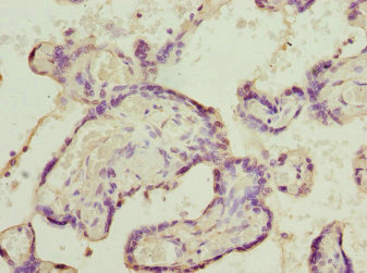 SH3GL1 / EEN Antibody - Immunohistochemistry of paraffin-embedded human placenta tissue at dilution 1:100