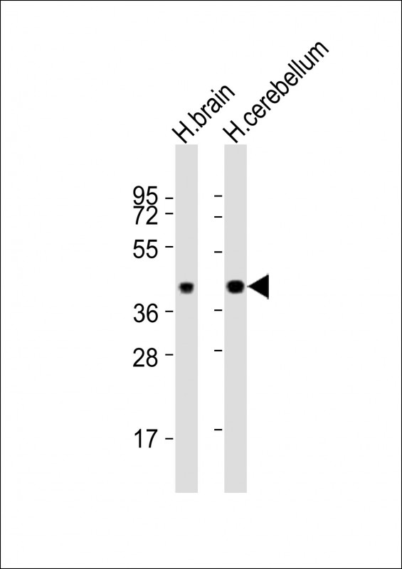 SH3GL2 Antibody - All lanes : Anti-SH3GL2 Antibody at 1:8000 dilution Lane 1: human brain lysates Lane 2: human cerebellum lysates Lysates/proteins at 20 ug per lane. Secondary Goat Anti-Rabbit IgG, (H+L), Peroxidase conjugated at 1/10000 dilution Predicted band size : 40 kDa Blocking/Dilution buffer: 5% NFDM/TBST.