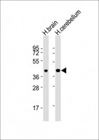 SH3GL2 Antibody - All lanes : Anti-SH3GL2 Antibody at 1:8000 dilution Lane 1: human brain lysates Lane 2: human cerebellum lysates Lysates/proteins at 20 ug per lane. Secondary Goat Anti-Rabbit IgG, (H+L), Peroxidase conjugated at 1/10000 dilution Predicted band size : 40 kDa Blocking/Dilution buffer: 5% NFDM/TBST.
