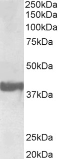 SH3GL2 Antibody - (0.3?g/ml) staining of Human Frontal Cortex lysate (35?g protein in RIPA buffer). Primary incubation was 1 hour. Detected by chemiluminescence, using streptavidin-HRP and using NAP blocker as a substitute for skimmed milk.