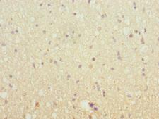 SH3GL2 Antibody - Immunohistochemistry of paraffin-embedded human brain tissue at dilution 1:100