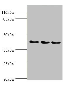 SH3GL2 Antibody - Western blot All Lanes:SH3GL2 antibody at 0.91ug/ml Lane 1:Hela whole cell lysate Lane 2:293T whole cell lysate Lane 3:HepG2 whole cell lysate Secondary Goat polyclonal to rabbit at 1/10000 dilution Predicted band size: 40kDa Observed band size: 40kDa