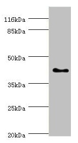 SH3GL2 Antibody - Western blot All lanes: SH3GL2 antibody at 0.91µg/ml + HepG2 whole cell lysate Secondary Goat polyclonal to rabbit IgG at 1/10000 dilution Predicted band size: 40 kDa Observed band size: 40 kDa