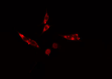 SH3GL2 Antibody - Staining HeLa cells by IF/ICC. The samples were fixed with PFA and permeabilized in 0.1% Triton X-100, then blocked in 10% serum for 45 min at 25°C. The primary antibody was diluted at 1:200 and incubated with the sample for 1 hour at 37°C. An Alexa Fluor 594 conjugated goat anti-rabbit IgG (H+L) antibody, diluted at 1/600, was used as secondary antibody.