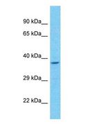SH3GL3 Antibody - Western blot of SH3GL3 Antibody with Jurkat Whole Cell lysate.  This image was taken for the unconjugated form of this product. Other forms have not been tested.