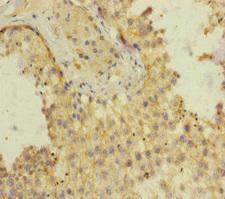 SH3GL3 Antibody - Immunohistochemistry of paraffin-embedded human testis tissue at dilution of 1:100