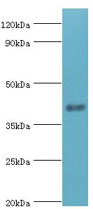SH3GLB1 / Bif / Endophilin B1 Antibody - Western blot. All lanes: Endophilin-B1 antibody at 2 ug/ml+mouse kidney tissue. Secondary antibody: Goat polyclonal to rabbit at 1:10000 dilution. Predicted band size: 41 kDa. Observed band size: 41 kDa Immunohistochemistry.