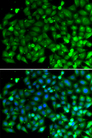 SH3GLB1 / Bif / Endophilin B1 Antibody - Immunofluorescence analysis of A549 cells.