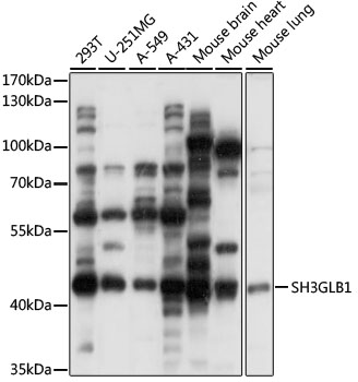 SH3GLB1 / Bif / Endophilin B1 Antibody - Western blot analysis of extracts of various cell lines, using SH3GLB1 antibody at 1:1000 dilution. The secondary antibody used was an HRP Goat Anti-Rabbit IgG (H+L) at 1:10000 dilution. Lysates were loaded 25ug per lane and 3% nonfat dry milk in TBST was used for blocking. An ECL Kit was used for detection and the exposure time was 30s.