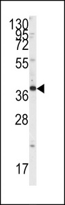 SH3GLB1 / Bif / Endophilin B1 Antibody - Western blot of anti-Endophilin B1 Antibody (Y80) in HepG2 cell line lysates (35 ug/lane). SH3GLB1 (arrow) was detected using the purified antibody.