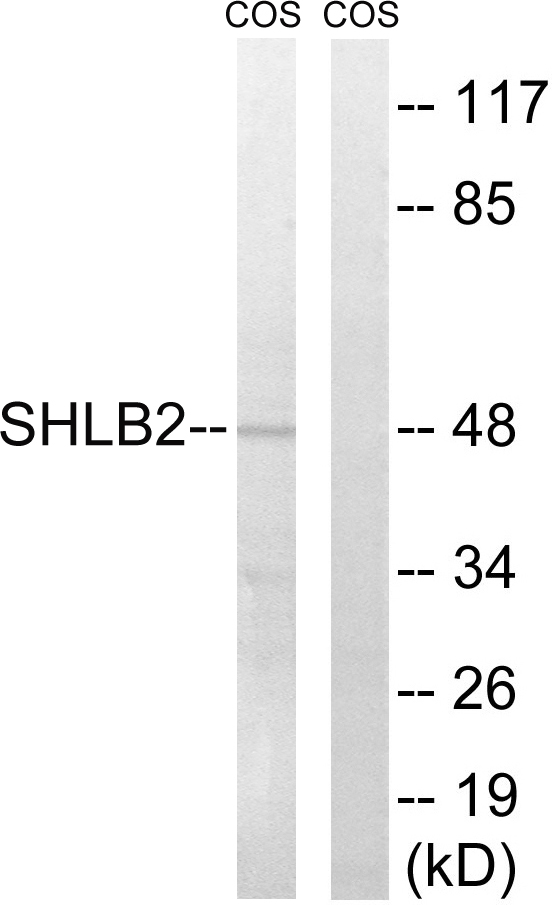 SH3GLB2 / Endophilin-B2 Antibody - Western blot analysis of lysates from COS7 cells, using SH3GLB2 Antibody. The lane on the right is blocked with the synthesized peptide.