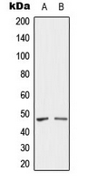 SH3GLB2 / Endophilin-B2 Antibody - Western blot analysis of SH3GLB2 expression in U87 (A); HY926 (B) whole cell lysates.
